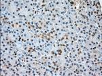 Profilin 1 Antibody in Immunohistochemistry (Paraffin) (IHC (P))