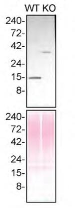 Profilin 1 Antibody in Western Blot (WB)