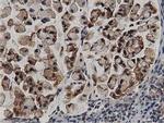 ACAT2 Antibody in Immunohistochemistry (Paraffin) (IHC (P))