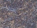 ACAT2 Antibody in Immunohistochemistry (Paraffin) (IHC (P))