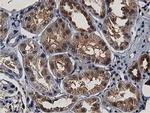 ACAT2 Antibody in Immunohistochemistry (Paraffin) (IHC (P))