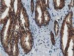 ACAT2 Antibody in Immunohistochemistry (Paraffin) (IHC (P))