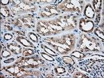 ACAT2 Antibody in Immunohistochemistry (Paraffin) (IHC (P))