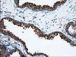 ACAT2 Antibody in Immunohistochemistry (Paraffin) (IHC (P))