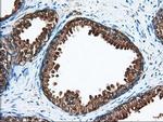 ACAT2 Antibody in Immunohistochemistry (Paraffin) (IHC (P))