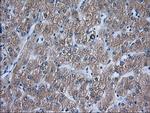 ACAT2 Antibody in Immunohistochemistry (Paraffin) (IHC (P))