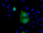 RAB17 Antibody in Immunocytochemistry (ICC/IF)