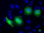 RAB17 Antibody in Immunocytochemistry (ICC/IF)