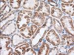 RAB17 Antibody in Immunohistochemistry (Paraffin) (IHC (P))