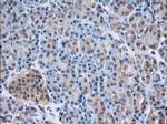 NXNL2 Antibody in Immunohistochemistry (Paraffin) (IHC (P))