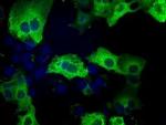 TACC3 Antibody in Immunocytochemistry (ICC/IF)