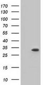 KHK Antibody in Western Blot (WB)