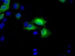 BDH2 Antibody in Immunocytochemistry (ICC/IF)