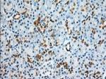 BDH2 Antibody in Immunohistochemistry (Paraffin) (IHC (P))