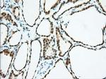 BDH2 Antibody in Immunohistochemistry (Paraffin) (IHC (P))