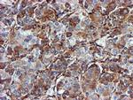 CYB5R3 Antibody in Immunohistochemistry (Paraffin) (IHC (P))