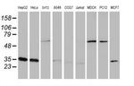 CYB5R3 Antibody in Western Blot (WB)