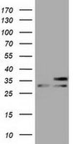 FHL1 Antibody in Western Blot (WB)