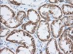 HIBCH Antibody in Immunohistochemistry (Paraffin) (IHC (P))