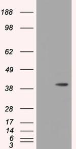 HIBCH Antibody in Western Blot (WB)