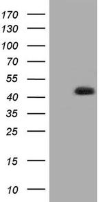 HIBCH Antibody in Western Blot (WB)