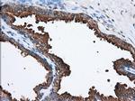 PANK2 Antibody in Immunohistochemistry (Paraffin) (IHC (P))