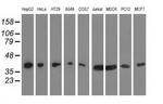 HIBCH Antibody in Western Blot (WB)