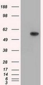 Thromboxane synthase Antibody in Western Blot (WB)