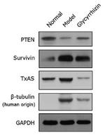 Thromboxane synthase Antibody in Western Blot (WB)