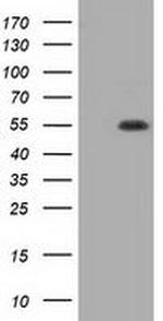 Thromboxane synthase Antibody in Western Blot (WB)