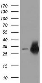 CRYM Antibody in Western Blot (WB)