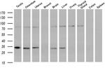 CRYM Antibody in Western Blot (WB)