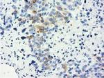 LIN7B Antibody in Immunohistochemistry (Paraffin) (IHC (P))