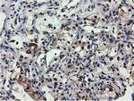 QPRT Antibody in Immunohistochemistry (Paraffin) (IHC (P))