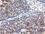 QPRT Antibody in Immunohistochemistry (Paraffin) (IHC (P))