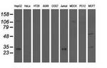 QPRT Antibody in Western Blot (WB)