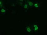 UCK1 Antibody in Immunocytochemistry (ICC/IF)