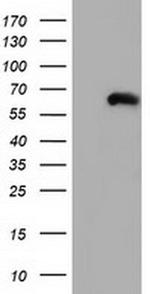 Coronin 1B Antibody in Western Blot (WB)