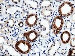 QPRT Antibody in Immunohistochemistry (Paraffin) (IHC (P))