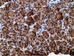 EPHX2 Antibody in Immunohistochemistry (Paraffin) (IHC (P))