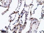 EPHX2 Antibody in Immunohistochemistry (Paraffin) (IHC (P))