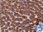 EPHX2 Antibody in Immunohistochemistry (Paraffin) (IHC (P))