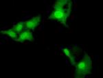 NSE2 Antibody in Immunocytochemistry (ICC/IF)