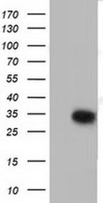 SULT2A1 Antibody in Western Blot (WB)