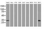 SULT2A1 Antibody in Western Blot (WB)