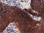 PRKD2 Antibody in Immunohistochemistry (Paraffin) (IHC (P))