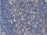 PRKD2 Antibody in Immunohistochemistry (Paraffin) (IHC (P))