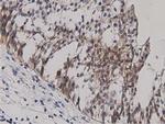 PRKD2 Antibody in Immunohistochemistry (Paraffin) (IHC (P))