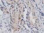 PRKD2 Antibody in Immunohistochemistry (Paraffin) (IHC (P))