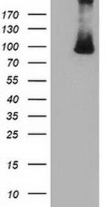 PRKD2 Antibody in Western Blot (WB)